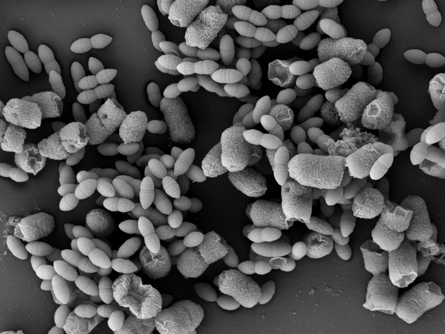 Elektronenmikroskopische Aufnahme von Methanobrevibacter smithii (klein, spitz) in Symbiose mit E. coli (groß, eckig)