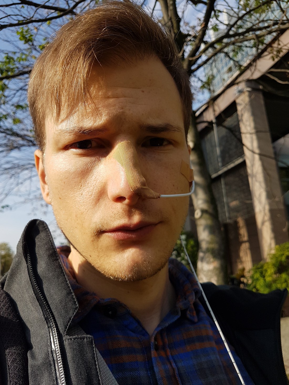 Ösophagusmanometrie und 24h-Impedanz-pH-Metrie, Untersuchungsfoto 1