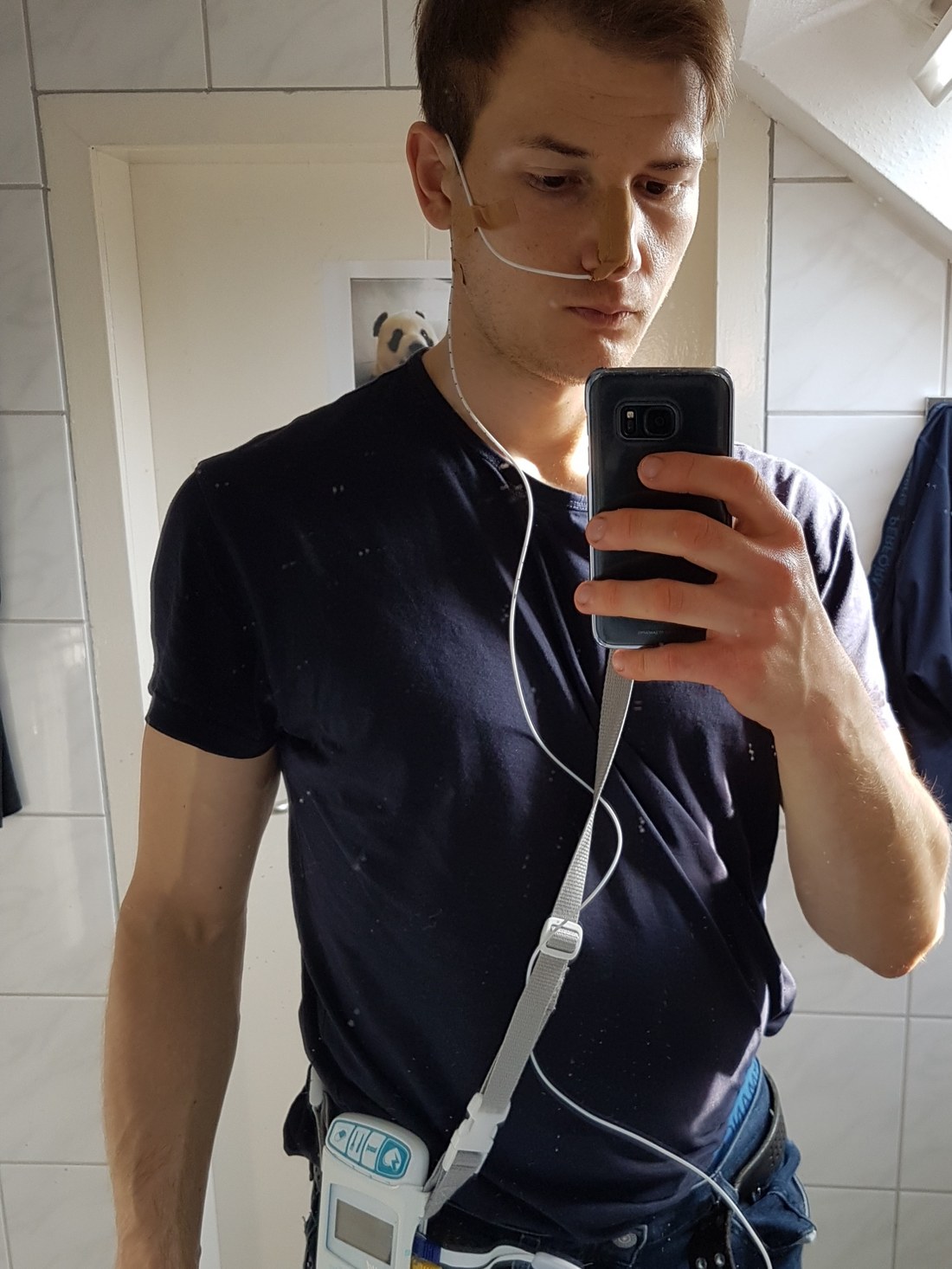 Ösophagusmanometrie und 24h-Impedanz-pH-Metrie, Untersuchungsfoto 2