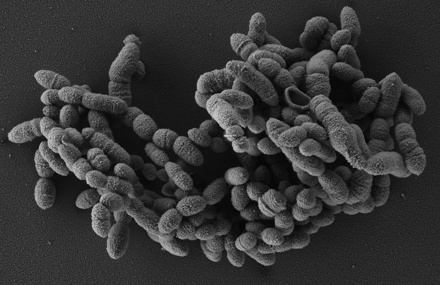 Elektronenmikroskopische Aufnahme von Methanobrevibacter-smithii-Zellclustern