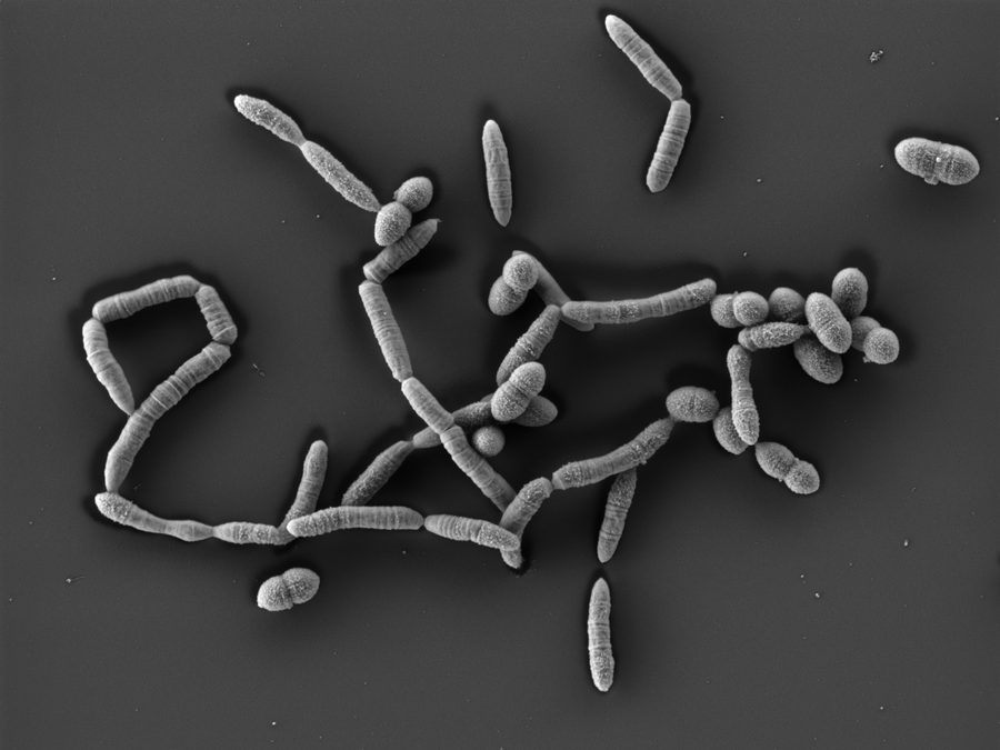 Elektronenmikroskopische Aufnahme einzelner Methanobrevibacter-smithii-Zellen